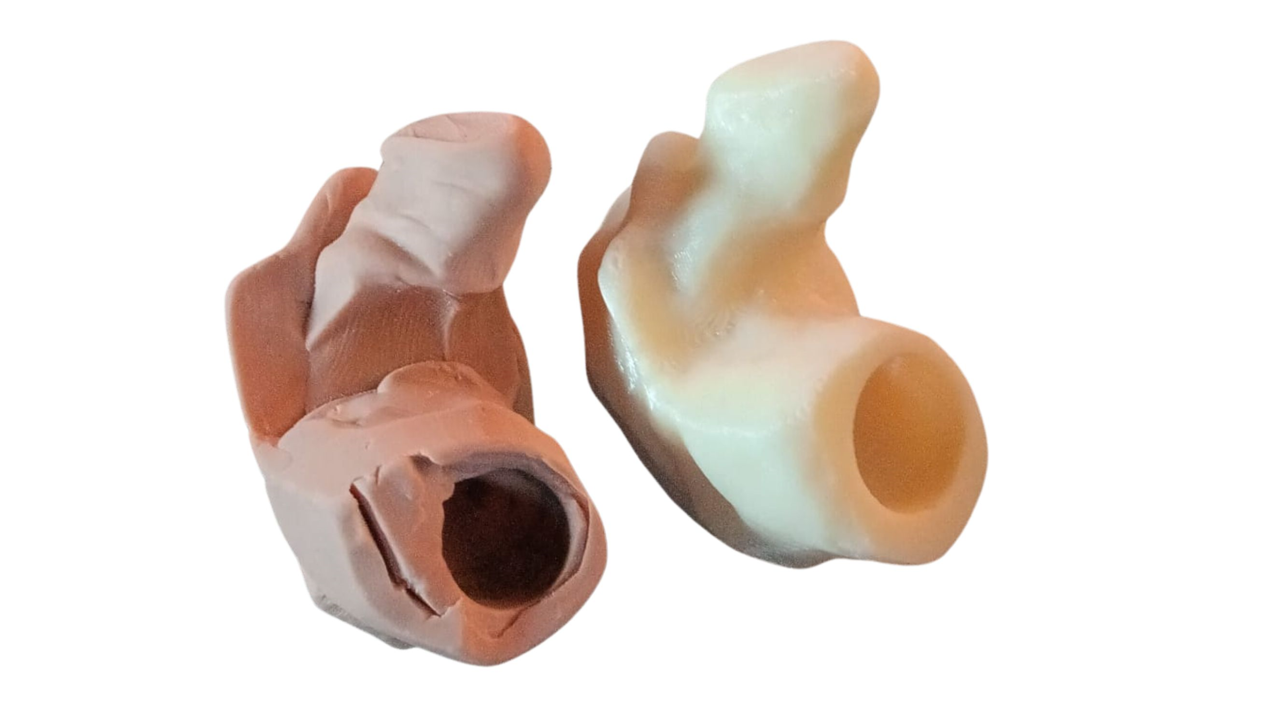 protesi replicata da a3ds con reverse engineeringe stampa 3d