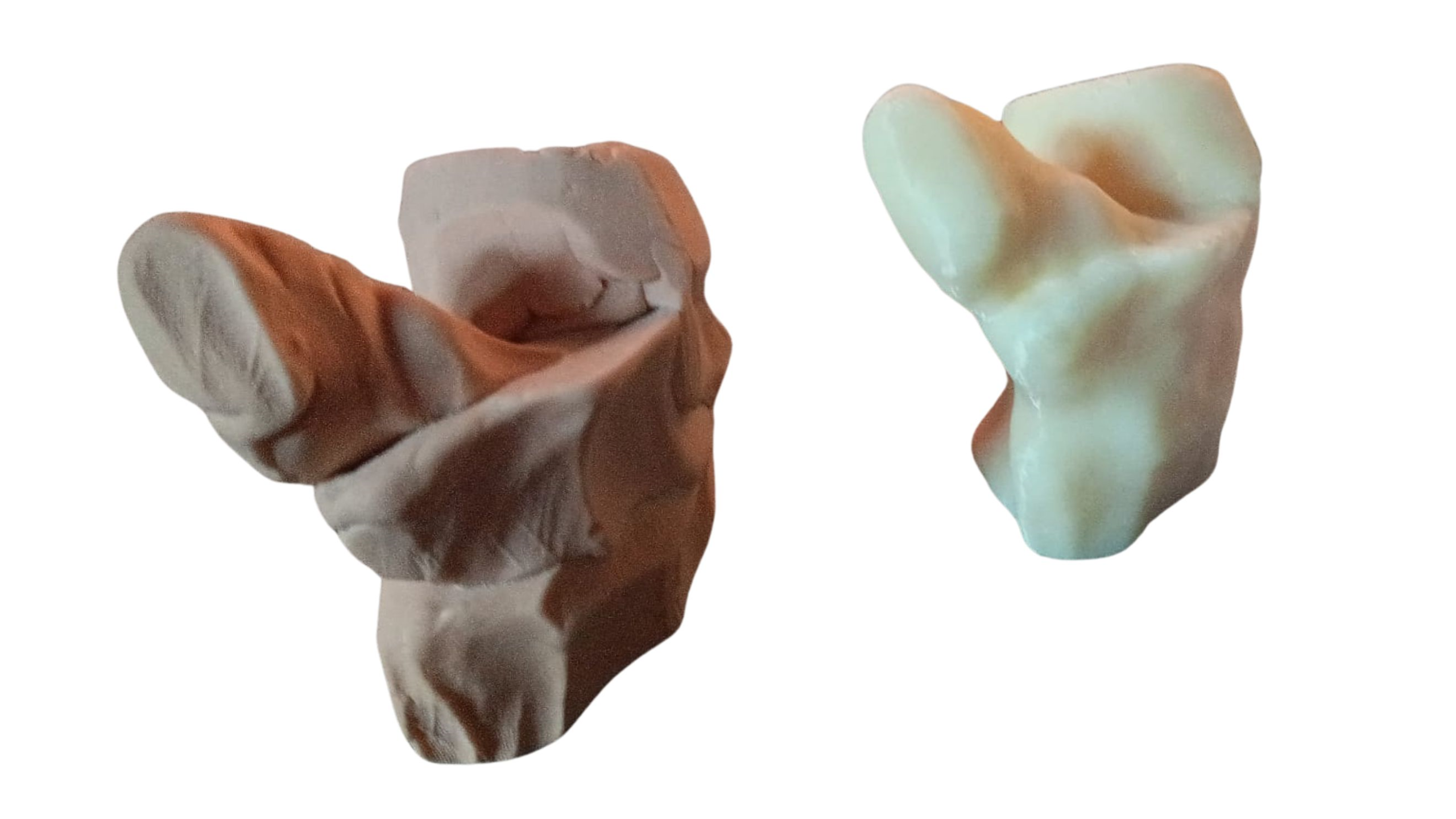 protesi replicata da a3ds con reverse engineeringe stampa 3d