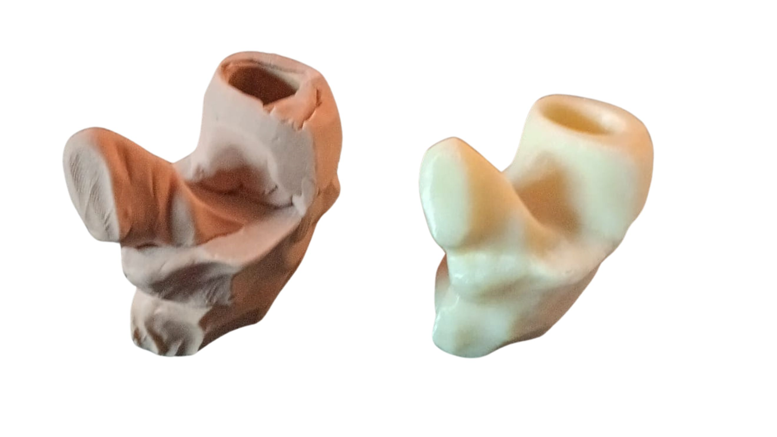 protesi replicata da a3ds con reverse engineeringe stampa 3d