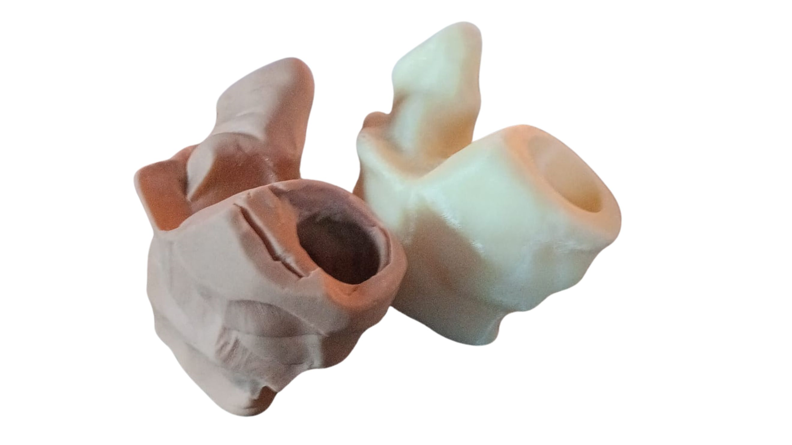 protesi replicata da a3ds con reverse engineeringe stampa 3d
