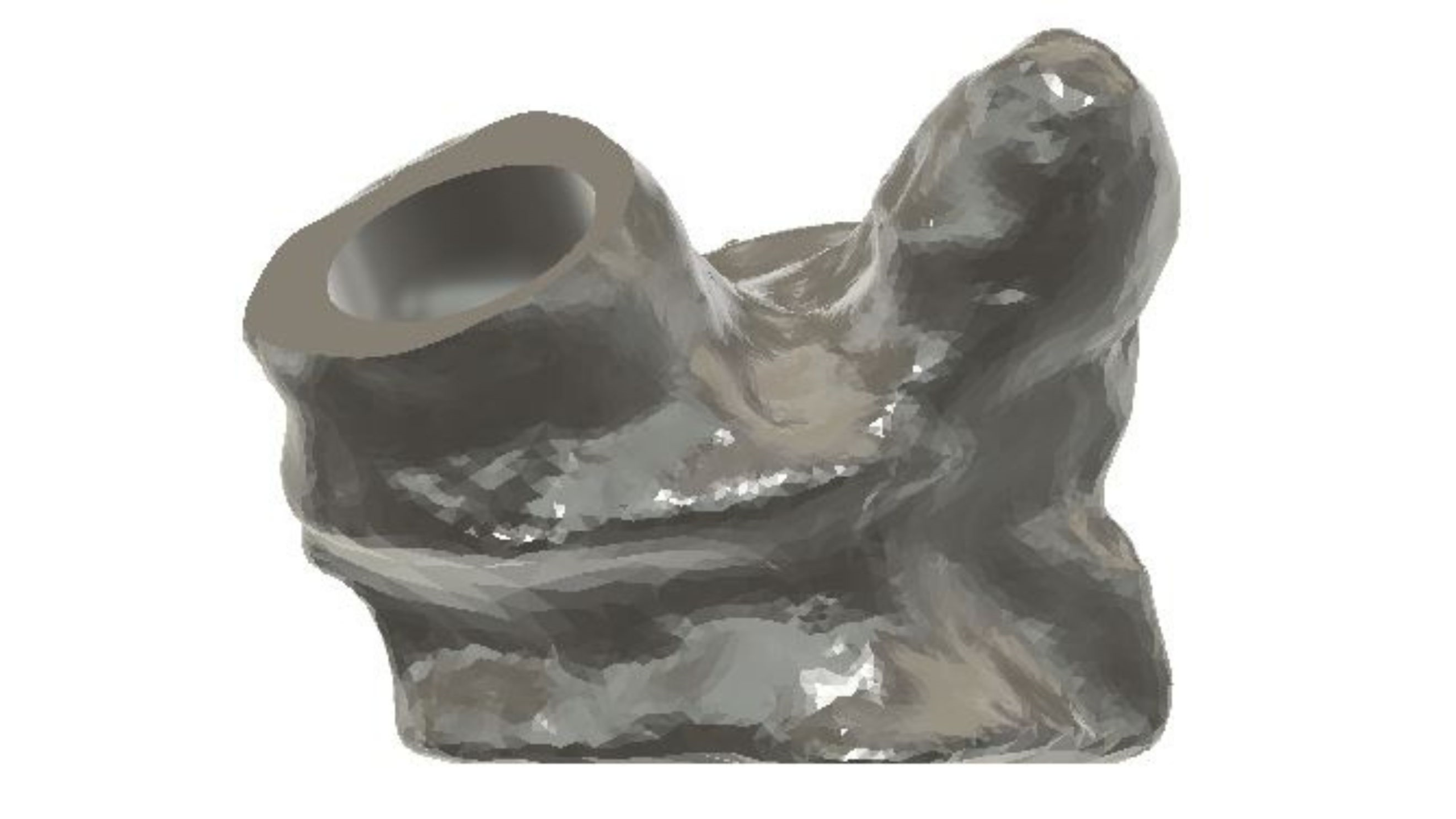 protesi replicata da a3ds con reverse engineeringe stampa 3d