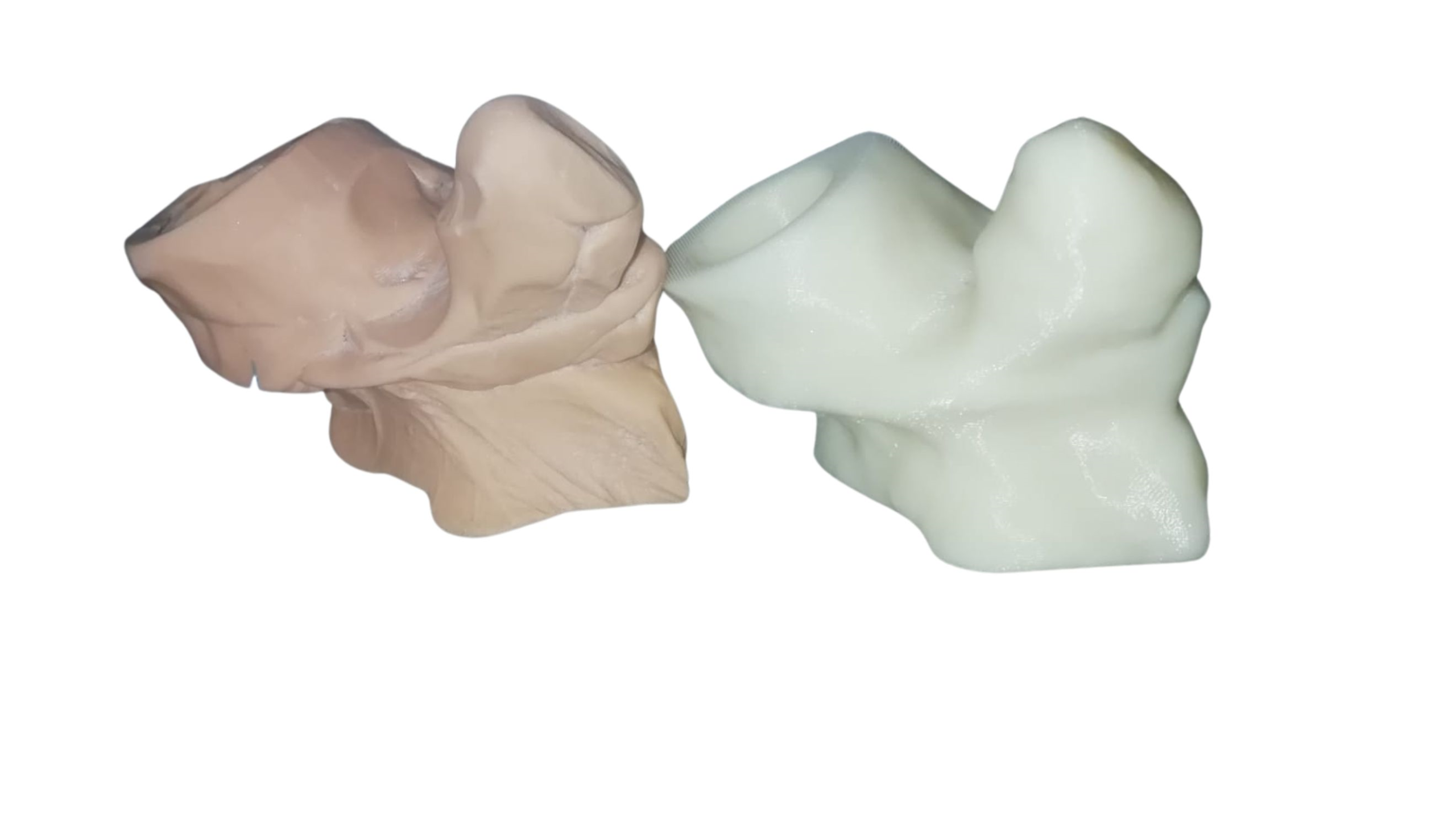 protesi replicata da a3ds con reverse engineeringe stampa 3d